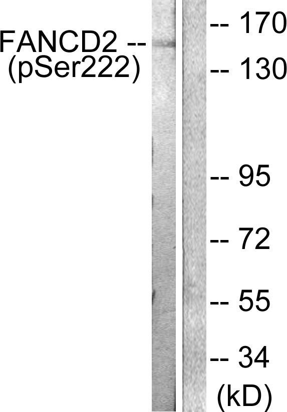 FANCD2 Antibody - Western blot analysis of lysates from HT29 cells treated with Calyculin A 50ng/ml 30', using FANCD2 (Phospho-Ser222) Antibody. The lane on the right is blocked with the phospho peptide.