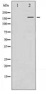 FANCD2 Antibody - Western blot of FANCD2 phosphorylation expression in Calyculin A treated HT29 whole cell lysates,The lane on the left is treated with the antigen-specific peptide.