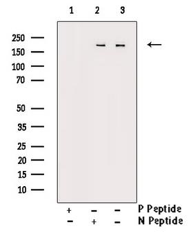 FANCD2 Antibody - Western blot analysis of Phospho-FANCD2 (Ser222) antibody expression in CalyculinA treated HT29 cells lysates. The lane on the right is treated with the antigen-specific peptide.