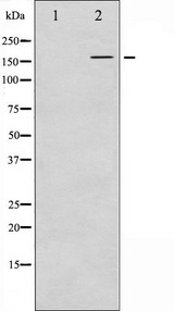 FANCD2 Antibody - Western blot analysis of FANCD2 phosphorylation expression in CalyculinA treated HT29 whole cells lysates. The lane on the left is treated with the antigen-specific peptide.
