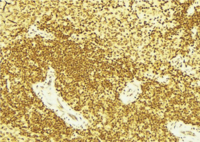 FANCD2 Antibody - 1:100 staining mouse spleen tissue by IHC-P. The sample was formaldehyde fixed and a heat mediated antigen retrieval step in citrate buffer was performed. The sample was then blocked and incubated with the antibody for 1.5 hours at 22°C. An HRP conjugated goat anti-rabbit antibody was used as the secondary.
