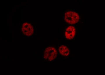 FANCD2 Antibody - Staining HT29 cells by IF/ICC. The samples were fixed with PFA and permeabilized in 0.1% Triton X-100, then blocked in 10% serum for 45 min at 25°C. The primary antibody was diluted at 1:200 and incubated with the sample for 1 hour at 37°C. An Alexa Fluor 594 conjugated goat anti-rabbit IgG (H+L) Ab, diluted at 1/600, was used as the secondary antibody.