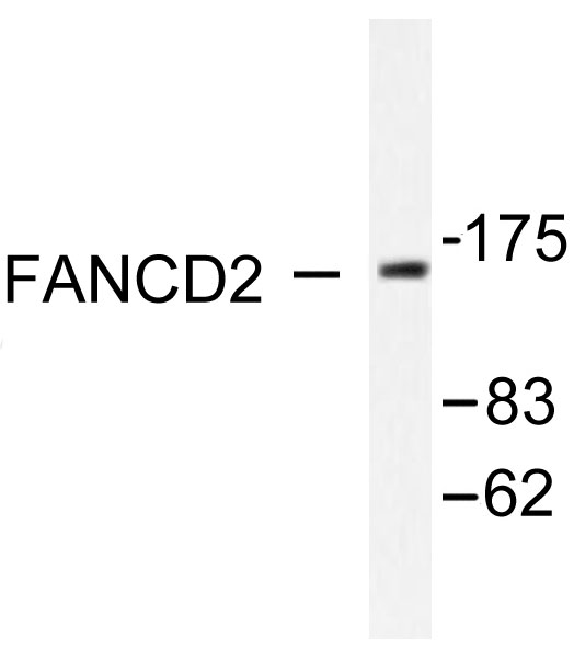 FANCD2 Antibody - Western blot of FANCD2 (P216) pAb in extracts from HT-29 treated with Calyculin A 50ng/ml 30'.