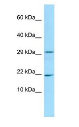 FANCD2OS Antibody - FANCD2OS antibody Western Blot of Rat Pancreas.  This image was taken for the unconjugated form of this product. Other forms have not been tested.