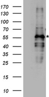 FANCE Antibody - HEK293T cells were transfected with the pCMV6-ENTRY control. (Left lane) or pCMV6-ENTRY FANCE. (Right lane) cDNA for 48 hrs and lysed. Equivalent amounts of cell lysates. (5 ug per lane) were separated by SDS-PAGE and immunoblotted with anti-FANCE rabbit polyclonal antibody.