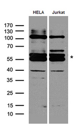 FANCE Antibody - Western blot analysis of extracts. (35ug) from different cell lines and tissues by using anti-FANCE rabbit polyclonal antibody.