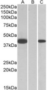 FANCF Antibody - HEK293 lysate (10ug protein in RIPA buffer) overexpressing Human FANCF with C-terminal MYC tag probed with (1ug/ml) in Lane A and probed with anti-MYC Tag (1/1000) in lane C. Mock-transfected HEK293 probed (1mg/ml) in Lane B. Primary