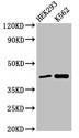 FANCF Antibody - Western Blot Positive WB detected in:HEK293 whole cell lysate,K562 whole cell lysate All Lanes:FANCF antibody at 3µg/ml Secondary Goat polyclonal to rabbit IgG at 1/50000 dilution Predicted band size: 43 KDa Observed band size: 43 KDa