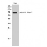 FANCG Antibody - Western blot of Phospho-FANCG (S383) antibody