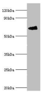 FANCG Antibody - Western blot All lanes: Fanconi anemia group G protein antibody at 4µg/ml + Mouse gonad tissue Secondary Goat polyclonal to rabbit IgG at 1/10000 dilution Predicted band size: 69 kDa Observed band size: 69 kDa