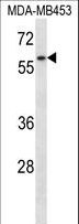 FANCG Antibody - FANCG Antibody western blot of MDA-MB453 cell line lysates (35 ug/lane). The FANCG antibody detected the FANCG protein (arrow).