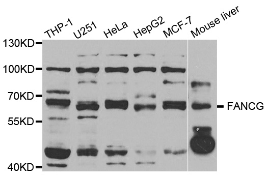 FANCG Antibody - Western blot analysis of extracts of various cell lines, using FANCG antibody.