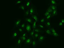 FANCG Antibody - Immunofluorescence staining of FANCG in A549 cells. Cells were fixed with 4% PFA, permeabilzed with 0.1% Triton X-100 in PBS, blocked with 10% serum, and incubated with rabbit anti-Human FANCG polyclonal antibody (dilution ratio 1:200) at 4°C overnight. Then cells were stained with the Alexa Fluor 488-conjugated Goat Anti-rabbit IgG secondary antibody (green). Positive staining was localized to Nucleus and Cytoplasm.