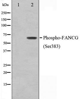 FANCG Antibody - Western blot analysis on K562 cell lysates using Phospho-FANCG(Ser383) antibody. The lane on the left is treated with the antigen-specific peptide.