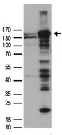 FANCI Antibody - HEK293T cells were transfected with the pCMV6-ENTRY control. (Left lane) or pCMV6-ENTRY FANCI. (Right lane) cDNA for 48 hrs and lysed
