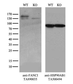 FANCI Antibody - Equivalent amounts of cell lysates  and FANCI-Knockout 293T cells  were separated by SDS-PAGE and immunoblotted with anti-FANCI monoclonal antibody(1:500`. Then the blotted membrane was stripped and reprobed with anti-HSP90AB1 antibody  as a loading control.