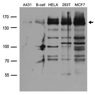 FANCI Antibody - Western blot analysis of extracts. (35ug) from different cell lines or tissues by using anti-FANCI rabbit polyclonal antibody .