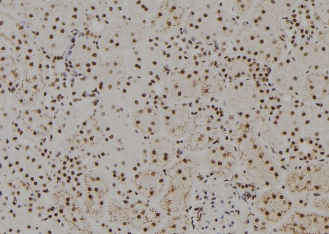 FANCM Antibody - 1:100 staining rat kidney tissue by IHC-P. The sample was formaldehyde fixed and a heat mediated antigen retrieval step in citrate buffer was performed. The sample was then blocked and incubated with the antibody for 1.5 hours at 22°C. An HRP conjugated goat anti-rabbit antibody was used as the secondary.