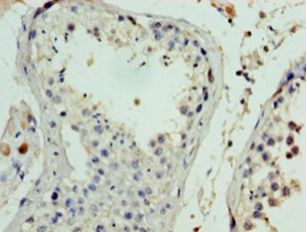 FANK1 Antibody - Immunohistochemistry of paraffin-embedded human testis tissue using antibody at 1:100 dilution.  This image was taken for the unconjugated form of this product. Other forms have not been tested.