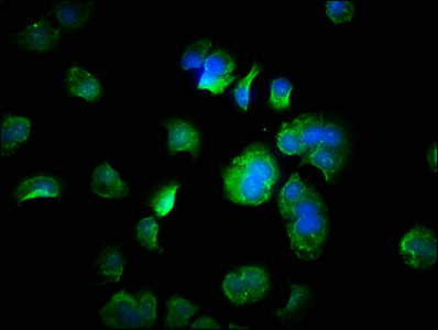 FANK1 Antibody - Immunofluorescence staining of MCF-7 cells with FANK1 Antibody at 1:333, counter-stained with DAPI. The cells were fixed in 4% formaldehyde, permeabilized using 0.2% Triton X-100 and blocked in 10% normal Goat Serum. The cells were then incubated with the antibody overnight at 4°C. The secondary antibody was Alexa Fluor 488-congugated AffiniPure Goat Anti-Rabbit IgG(H+L).