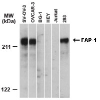 FAP-1 / PTPN13 Antibody - Western blot of FAP-1 using Polyclonal Antibody to FAP-1 at 1:2000. In ovarian carcinoma cell lines FAP-1 expression was detected in SK-OV-3 and OVCAR-3, but not in BG-1 or HEY. Human Jurkat T and 293 kidney cell lines were used as negative and positive controls, respectively.