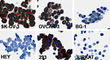 FAP-1 / PTPN13 Antibody - Immunocytochemistry of FAP-1 in cell lines using Polyclonal Antibody to FAP-1 at 1:2000. In ovarian carcinoma cell lines FAP-1 expression was detected in SK-OV-3 and OVCAR-3, but not in BG-1 or HEY. Human 293 kidney and Jurkat T cell lines were used as positive and negative controls, respectively. The staining data correlates with the western blot data (figure to the left).