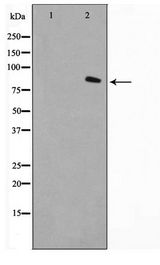 FAP-1 / PTPN13 Antibody - Western blot of LOVO cell lysate using FAP-1 Antibody