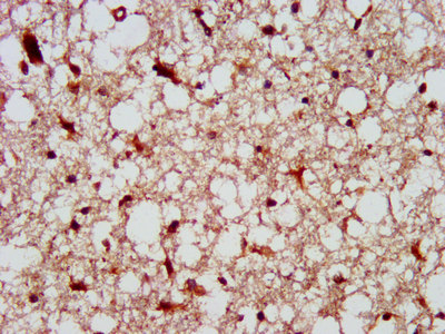 FAP-1 / PTPN13 Antibody - Immunohistochemistry image at a dilution of 1:300 and staining in paraffin-embedded human brain tissue performed on a Leica BondTM system. After dewaxing and hydration, antigen retrieval was mediated by high pressure in a citrate buffer (pH 6.0) . Section was blocked with 10% normal goat serum 30min at RT. Then primary antibody (1% BSA) was incubated at 4 °C overnight. The primary is detected by a biotinylated secondary antibody and visualized using an HRP conjugated SP system.