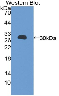 FAP Alpha Antibody - Western blot of recombinant FAP Alpha.