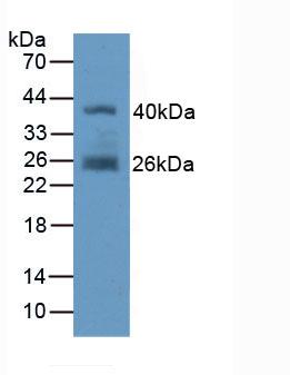 FAP Alpha Antibody - Western Blot; Sample: Recombinant FAPa, Human.