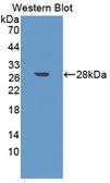 FAP Alpha Antibody - Western blot of FAP Alpha antibody using recombinant protein encoding aa542-761
