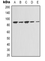 FAP Alpha Antibody - Western blot analysis of FAP alpha expression in HeLa (A); MCF7 (B); NIH3T3 (C); mouse kidney (D); rat liver (E) whole cell lysates.