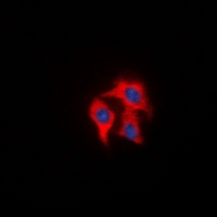 FAP Alpha Antibody - Immunofluorescent analysis of FAP alpha staining in HeLa cells. Formalin-fixed cells were permeabilized with 0.1% Triton X-100 in TBS for 5-10 minutes and blocked with 3% BSA-PBS for 30 minutes at room temperature. Cells were probed with the primary antibody in 3% BSA-PBS and incubated overnight at 4 deg C in a humidified chamber. Cells were washed with PBST and incubated with a DyLight 594-conjugated secondary antibody (red) in PBS at room temperature in the dark. DAPI was used to stain the cell nuclei (blue).