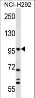 FAP Alpha Antibody - FAP Antibody western blot of NCI-H292 cell line lysates (35 ug/lane). The FAP antibody detected the FAP protein (arrow).