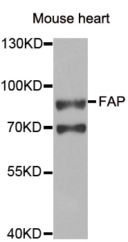 FAP Alpha Antibody - Western blot analysis of extracts of Mouse heart cells.