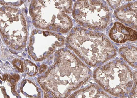 FAP Alpha Antibody - 1:100 staining human kidney tissue by IHC-P. The tissue was formaldehyde fixed and a heat mediated antigen retrieval step in citrate buffer was performed. The tissue was then blocked and incubated with the antibody for 1.5 hours at 22°C. An HRP conjugated goat anti-rabbit antibody was used as the secondary.