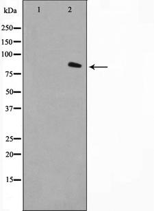 FAP Alpha Antibody - Western blot analysis on LOVO cells cell lysates using FAP-1 antibody. The lane on the left is treated with the antigen-specific peptide.