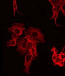 FAP Alpha Antibody - Staining LOVO cells by IF/ICC. The samples were fixed with PFA and permeabilized in 0.1% Triton X-100, then blocked in 10% serum for 45 min at 25°C. The primary antibody was diluted at 1:200 and incubated with the sample for 1 hour at 37°C. An Alexa Fluor 594 conjugated goat anti-rabbit IgG (H+L) Ab, diluted at 1/600, was used as the secondary antibody.
