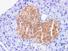 FAP Alpha Antibody - Immunohistochemistry of paraffin-embedded Mouse pancreas using FAP Polyclonal Antibody at dilution of 1:200.