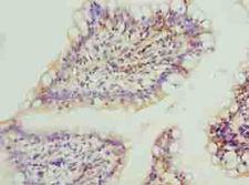 FAR2 Antibody - Immunohistochemistry of paraffin-embedded human small intestine tissue using antibody at dilution of 1:100.