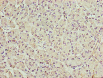 FAR2 Antibody - Immunohistochemistry of paraffin-embedded human pancreatic tissue using FAR2 Antibody at dilution of 1:100