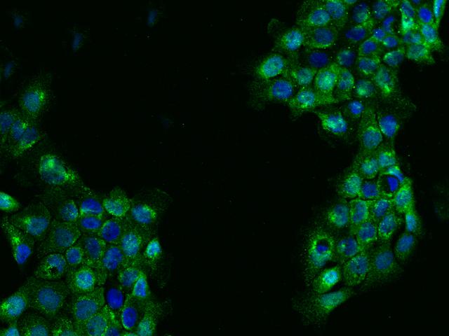 FAR2 Antibody - Immunofluorescence staining of FAR2 in A431 cells. Cells were fixed with 4% PFA, permeabilzed with 0.1% Triton X-100 in PBS, blocked with 10% serum, and incubated with rabbit anti-Human FAR2 polyclonal antibody (dilution ratio 1:200) at 4°C overnight. Then cells were stained with the Alexa Fluor 488-conjugated Goat Anti-rabbit IgG secondary antibody (green) and counterstained with DAPI (blue). Positive staining was localized to Cytoplasm.