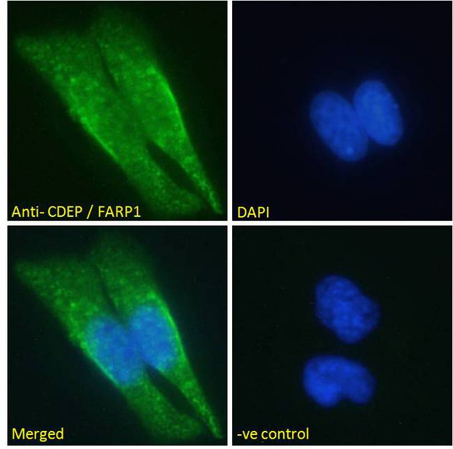 FARP1 / CDEP Antibody - Goat Anti-CDEP / FARP1 Antibody Immunofluorescence analysis of paraformaldehyde fixed HeLa cells, permeabilized with 0.15% Triton. Primary incubation 1hr (10ug/ml) followed by Alexa Fluor 488 secondary antibody (2ug/ml), showing cytoplasmic staining. The nuclear stain is DAPI (blue). Negative control: Unimmunized goat IgG (10ug/ml) followed by Alexa Fluor 488 secondary antibody (2ug/ml).