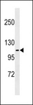 FARP1 / CDEP Antibody - FARP1 Antibody western blot of A375 cell line lysates (35 ug/lane). The FARP1 antibody detected the FARP1 protein (arrow).