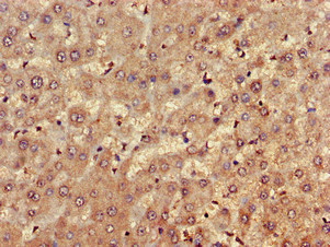 FARP1 / CDEP Antibody - Immunohistochemistry of paraffin-embedded human liver tissue using FARP1 Antibody at dilution of 1:100