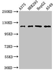 FARP1 / CDEP Antibody - Western Blot Positive WB detected in: A375 whole cell lysate, HEK293 whole cell lysate, HepG2 whole cell lysate, A549 whole cell lysate All lanes: FARP1 antibody at 3µg/ml Secondary Goat polyclonal to rabbit IgG at 1/50000 dilution Predicted band size: 119, 123, 15 kDa Observed band size: 119 kDa