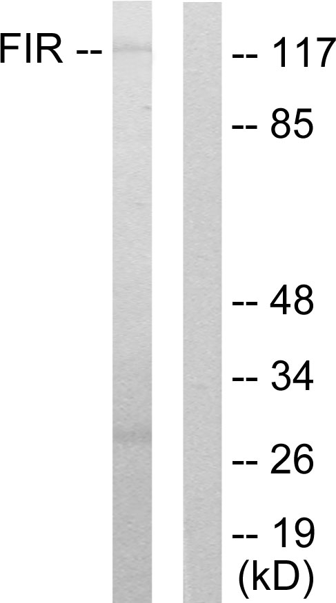 FARP2 / FRG Antibody - Western blot analysis of lysates from HUVEC cells, using FIR Antibody. The lane on the right is blocked with the synthesized peptide.