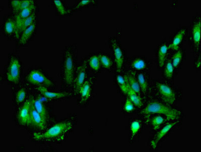FARP2 / FRG Antibody - Immunofluorescent analysis of Hela cells using FARP2 Antibody at dilution of 1:100 and Alexa Fluor 488-congugated AffiniPure Goat Anti-Rabbit IgG(H+L)