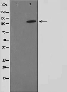 FARP2 / FRG Antibody - Western blot analysis on HuvEc cell lysates using FIR antibody. The lane on the left is treated with the antigen-specific peptide.