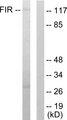 FARP2 / FRG Antibody - Western blot analysis of extracts from HuvEc cells, using FIR antibody.